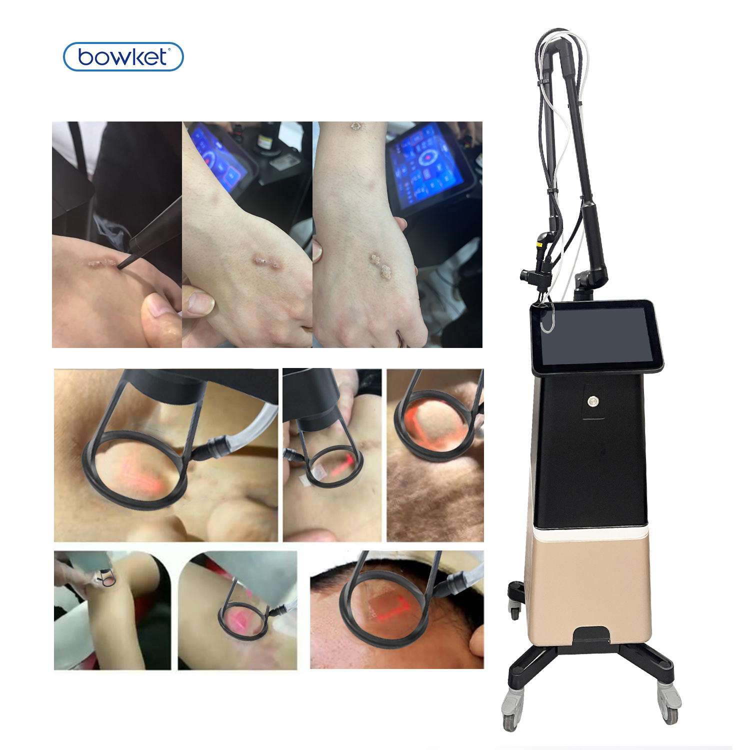 C02 Fractional Laser Machine(image 5)