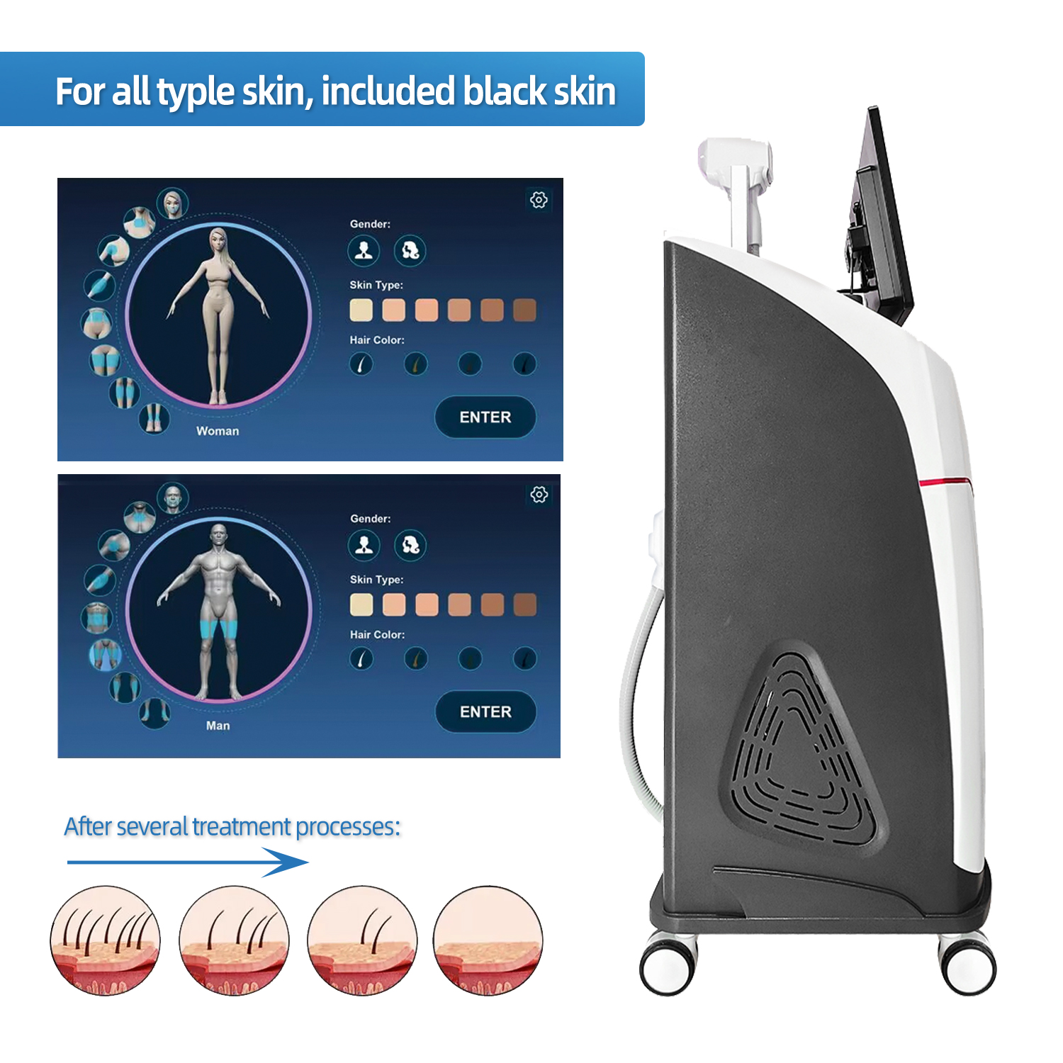 Hair Removal Diode Laser Machine(image 5)