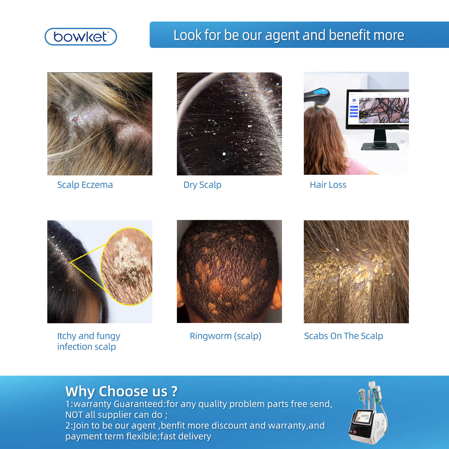 Al Smart Scalp Analyzer(image 3)